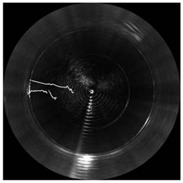 Sonar target detection method and system based on time history accumulated images