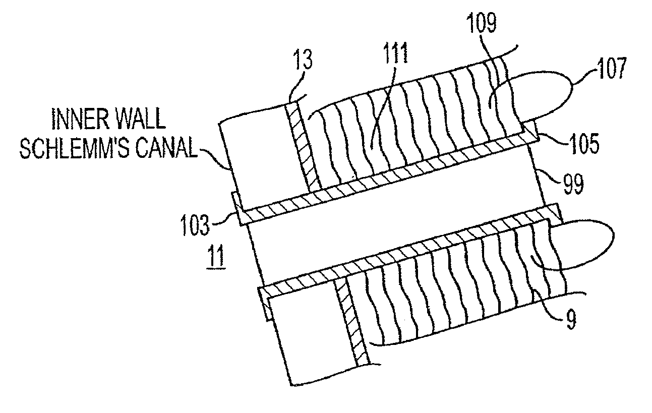 Delivery system and method of use for the eye