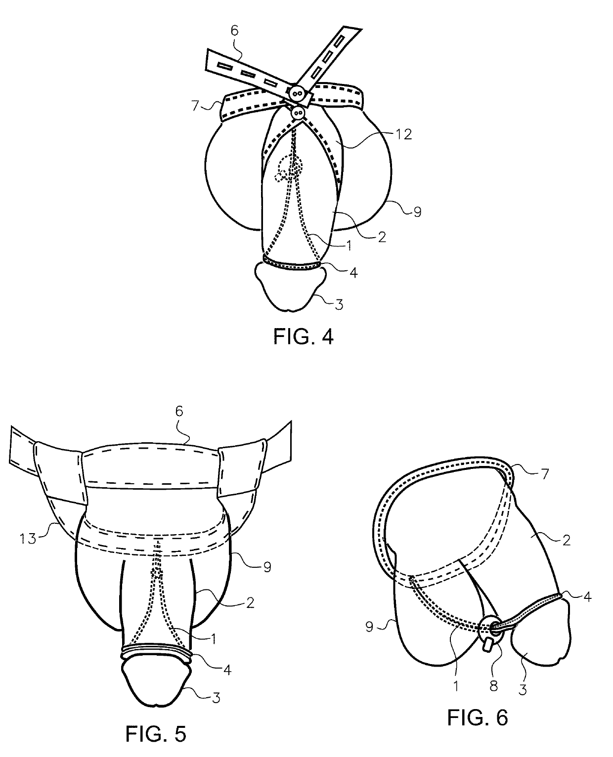 Glans penis extender or foreskin retractor