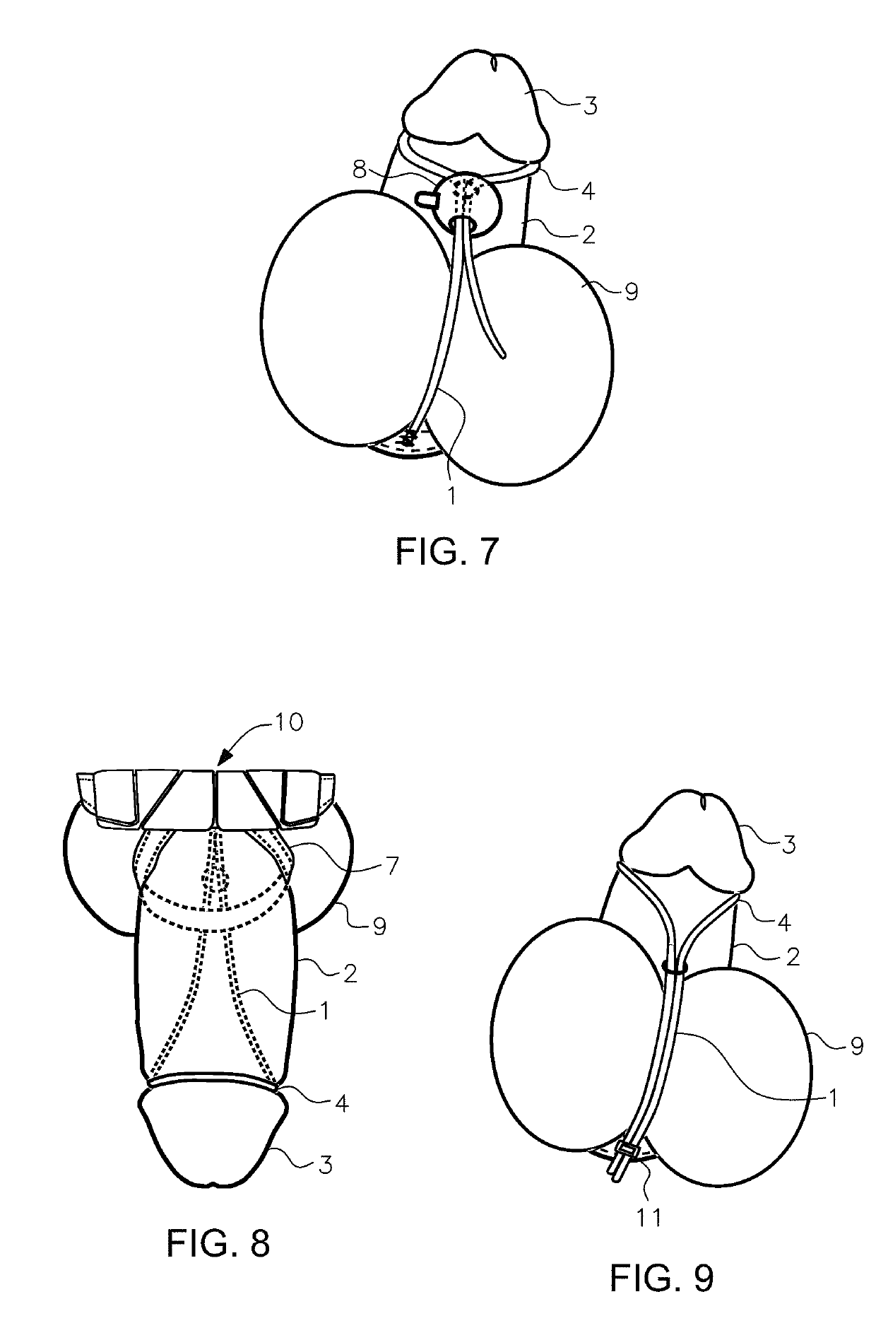 Glans penis extender or foreskin retractor