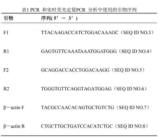 Gene sequence for expressing soluble recombinant human hyaluronidase PH20 in CHO (Chinese hamster ovary) cell