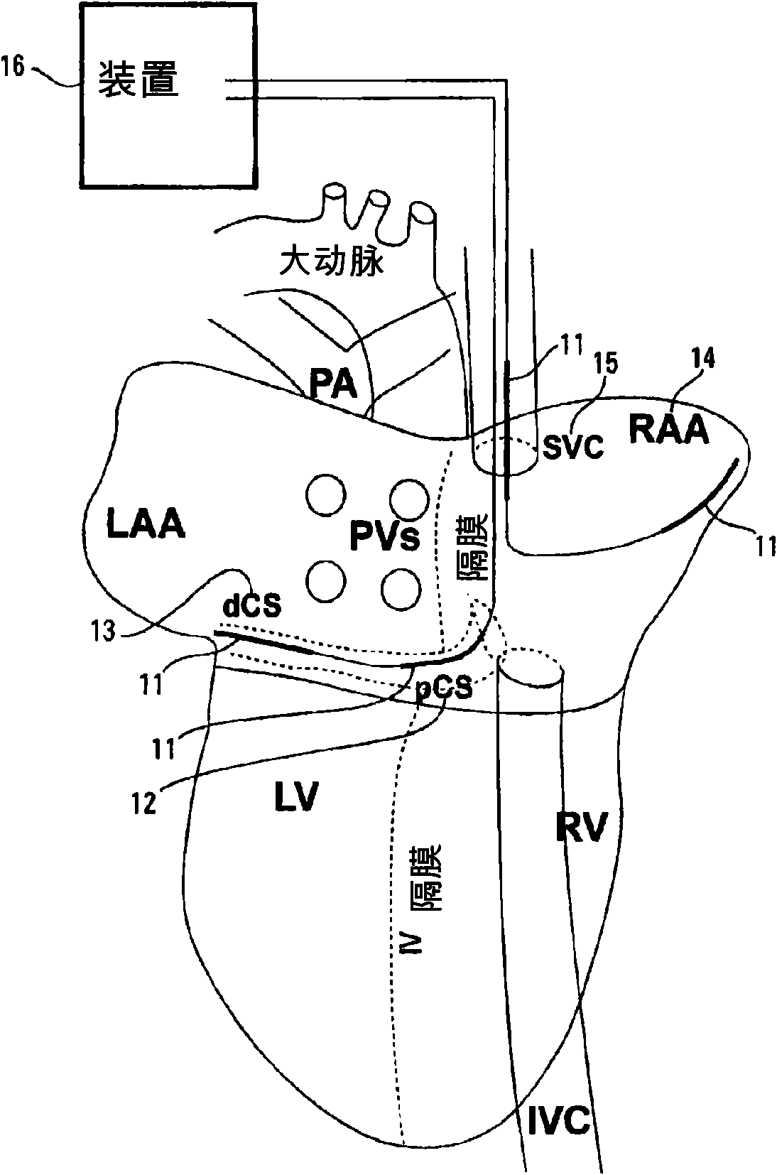 Method and device for low-energy termination of atrial tachyarrhythmias