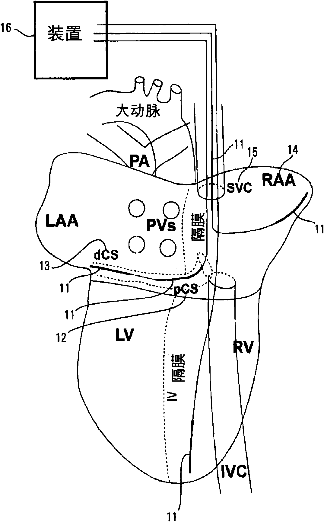 Method and device for low-energy termination of atrial tachyarrhythmias