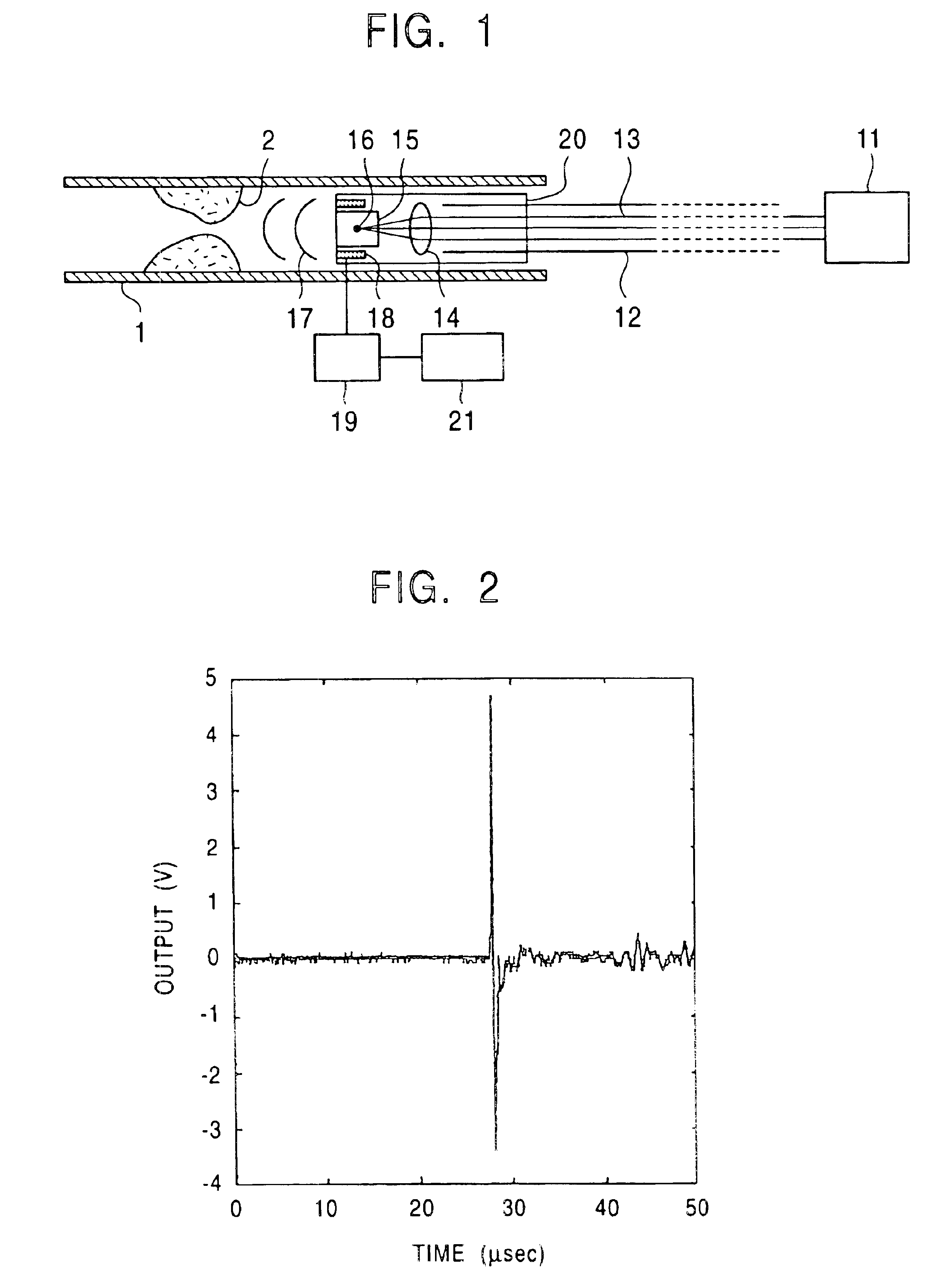 Ultrasonic angioscope system