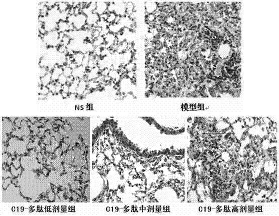 Application of chemokine-like factor derived polypeptide in inhibiting inflammatory lesion