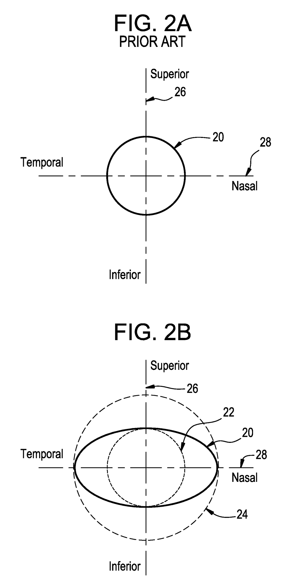 Rotationally stabilized contact lens with improved comfort and method of optimization