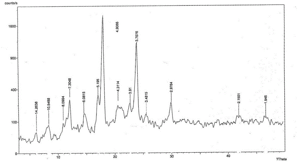 Parecoxib sodium pharmaceutical composition for injection and preparation method thereof