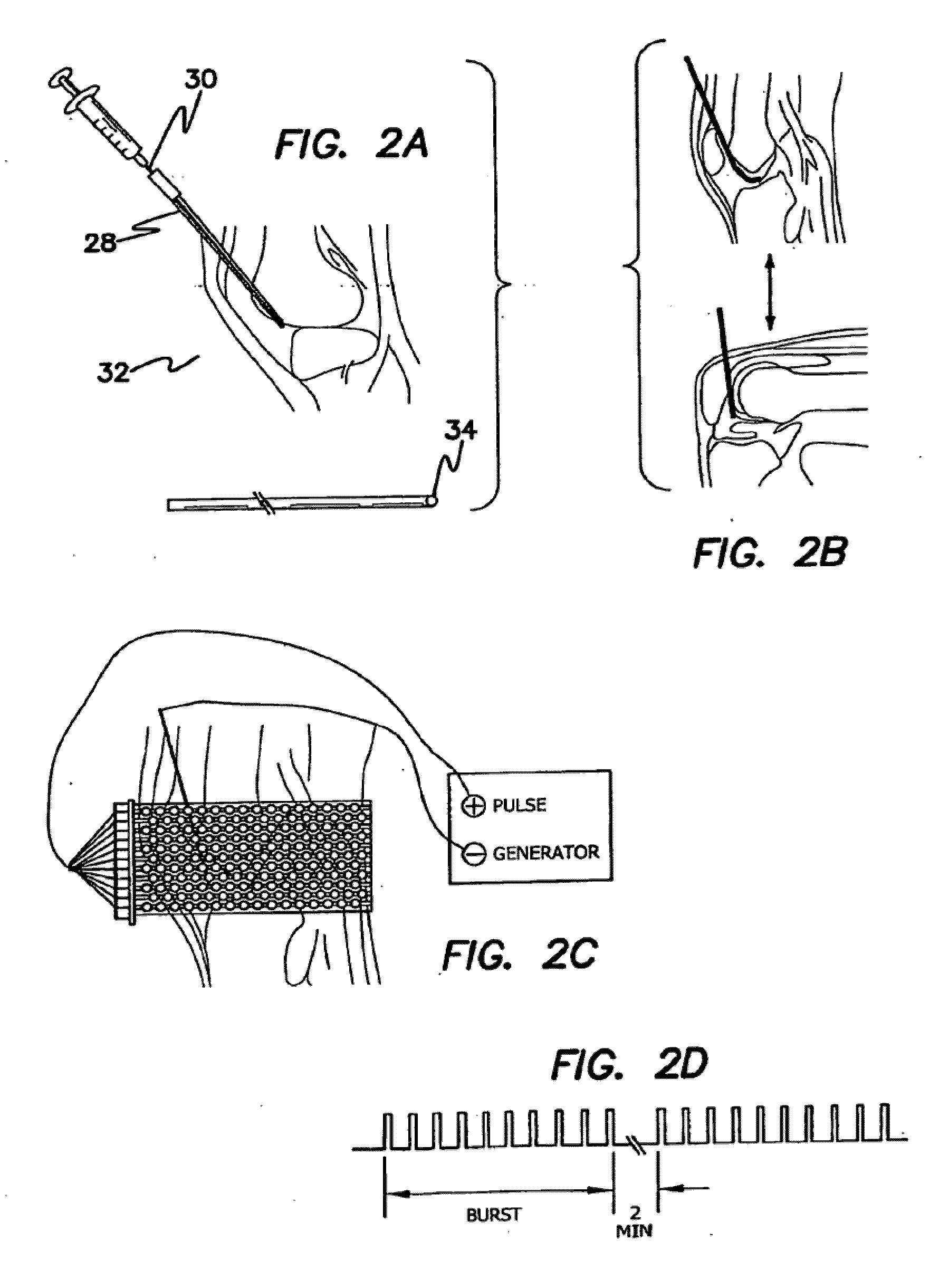 Method and apparatus of low strengh electric field network-mediated delnery of drug, gene, sirna, shrn, protein, peptide, antibody or other biomedical and therapeutic molecules and reagents in skin, soft tissue, joints and bone