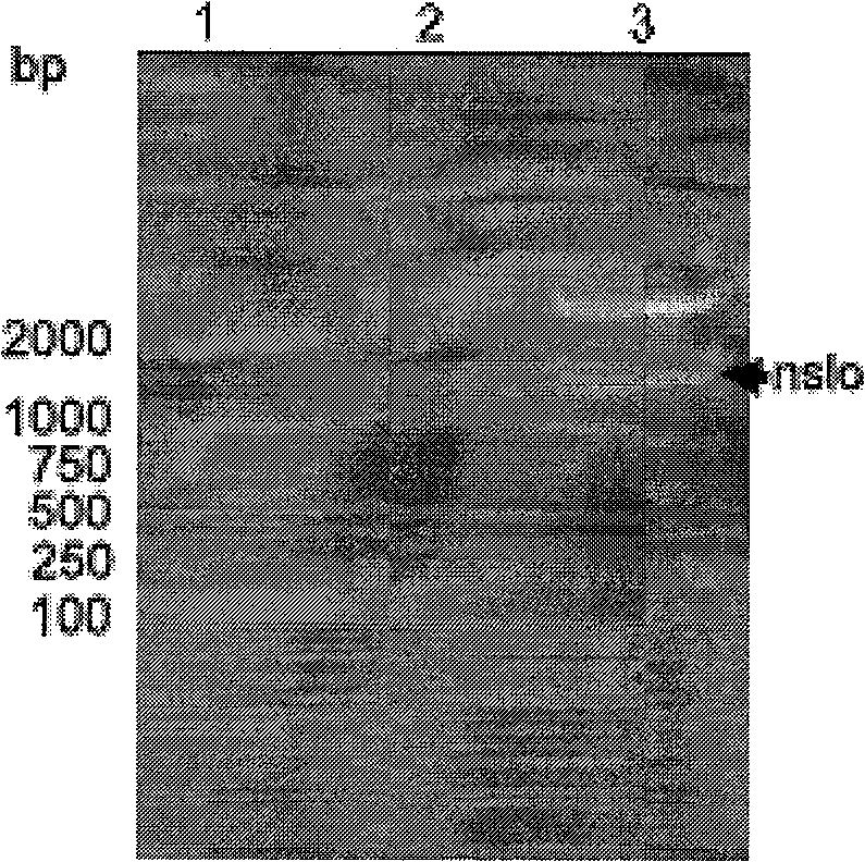 High-expression streptolysin O (SLO) gene as well as secreting expression vector and application thereof