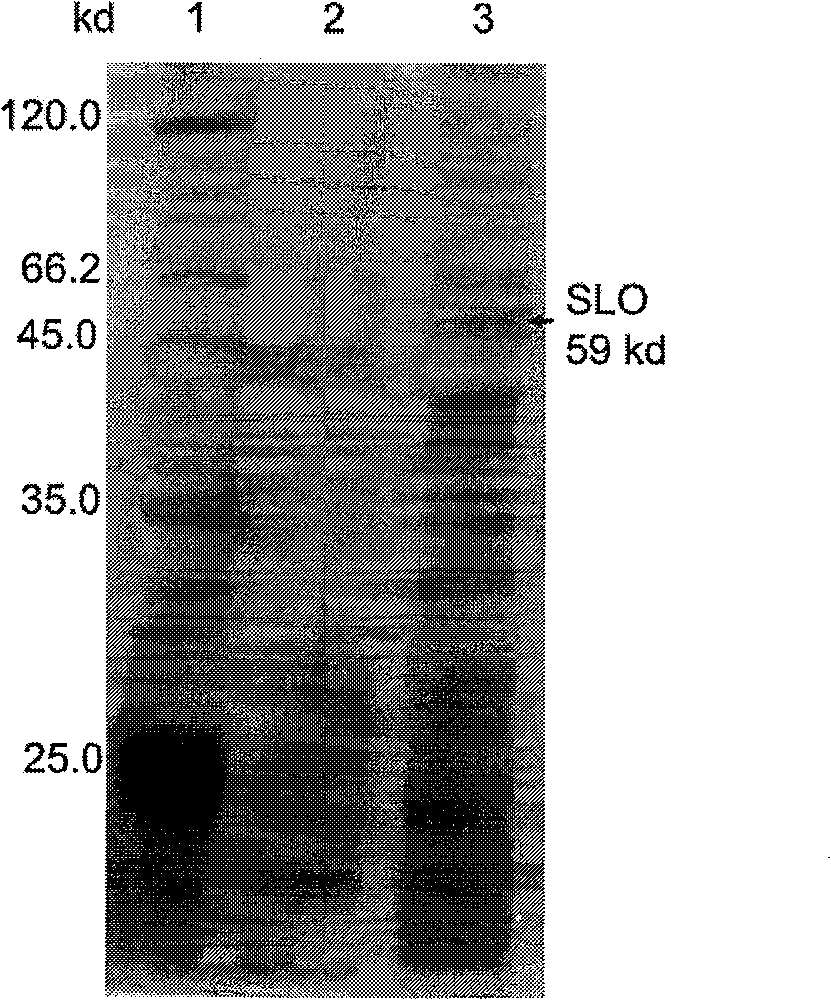 High-expression streptolysin O (SLO) gene as well as secreting expression vector and application thereof