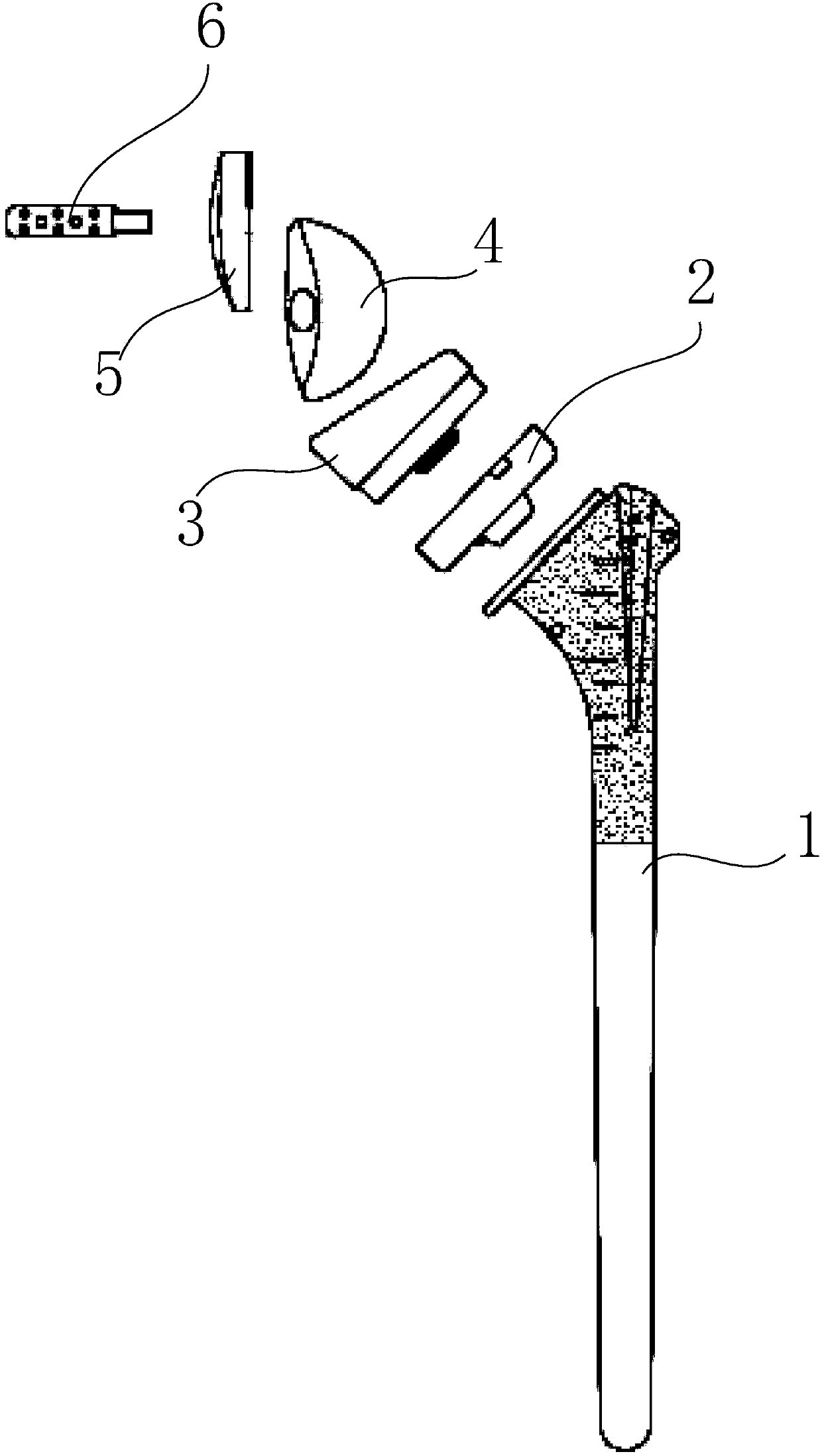 Assembled shoulder joint prosthesis component