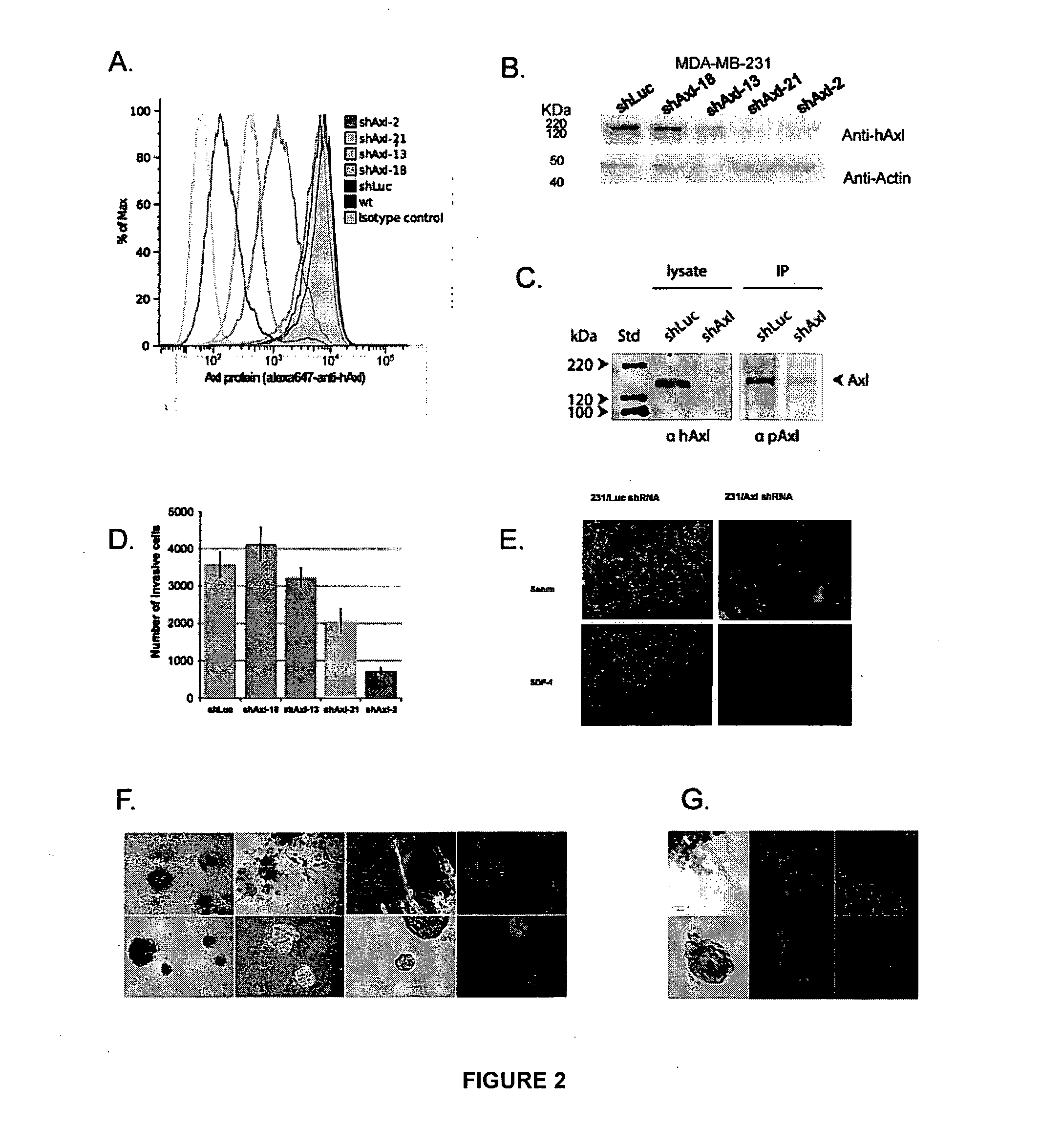 Methods using axl as a biomarker of epithelial-to-mesenchymal transition