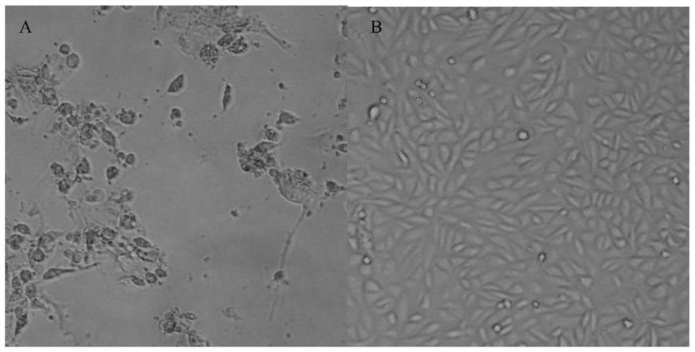 Culture and immunofluorescence quantitative detection method of human group H rotavirus