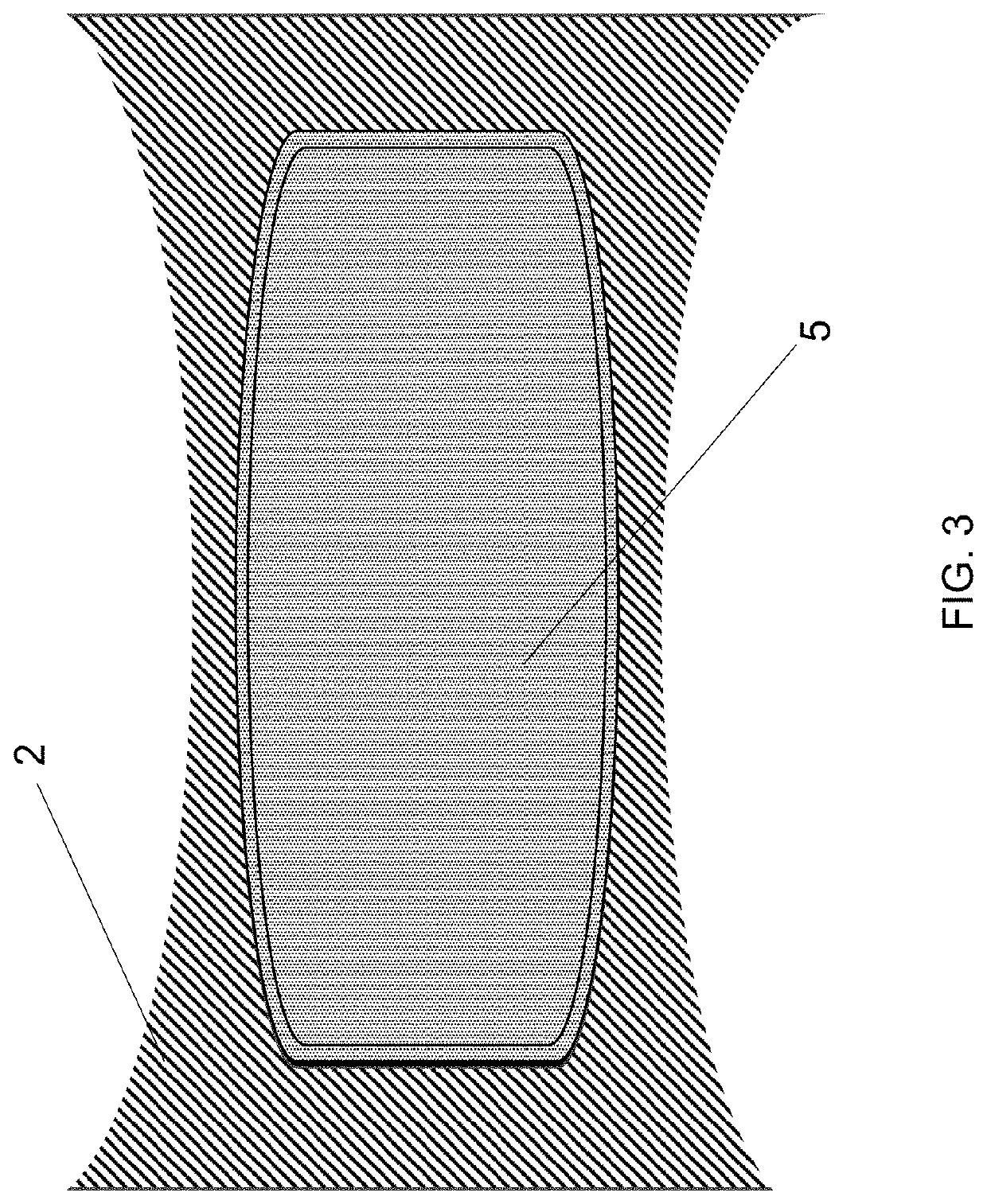 Athletic Apparel Configured to Manage Symptoms of Athletic Stress Induced Incontinence