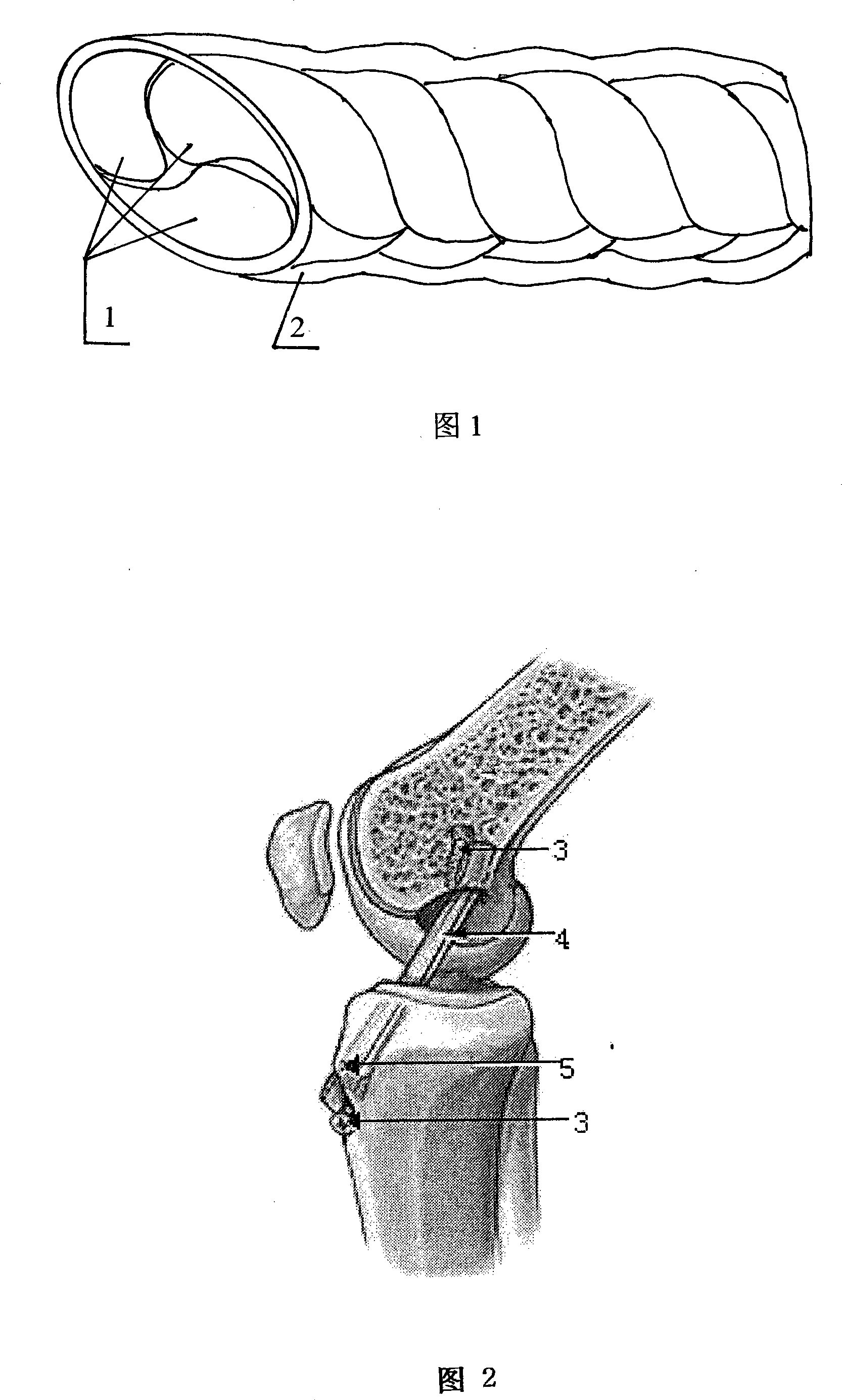 Method for preparing medical knee joint cruciate ligaments