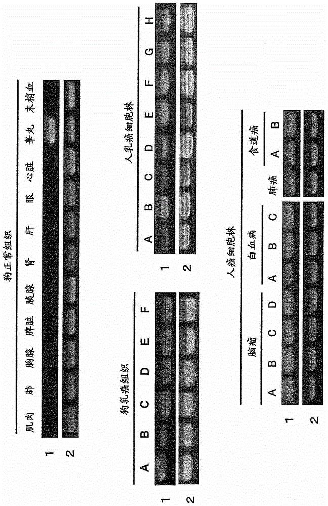 Pharmaceutical composition for cancer treatment and/or prevention