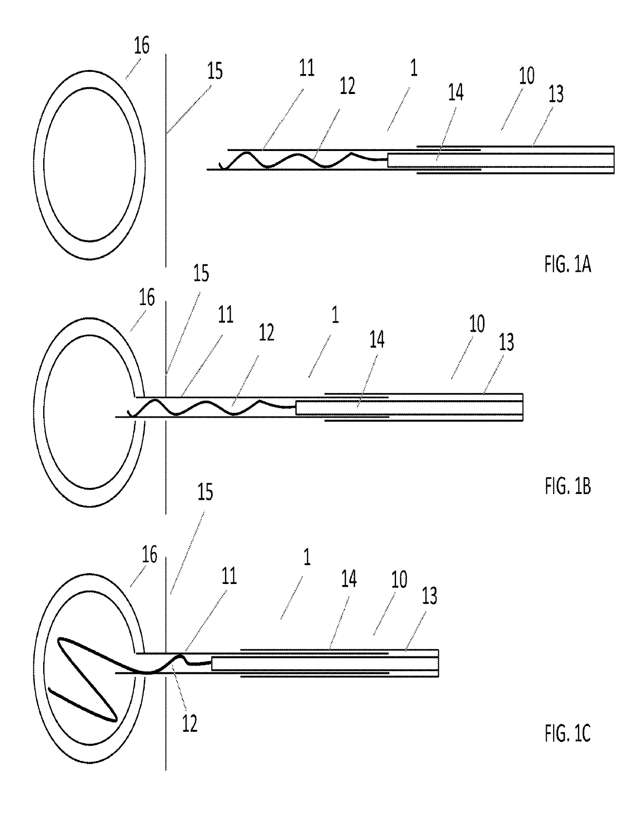 Systems and methods for implant delivery