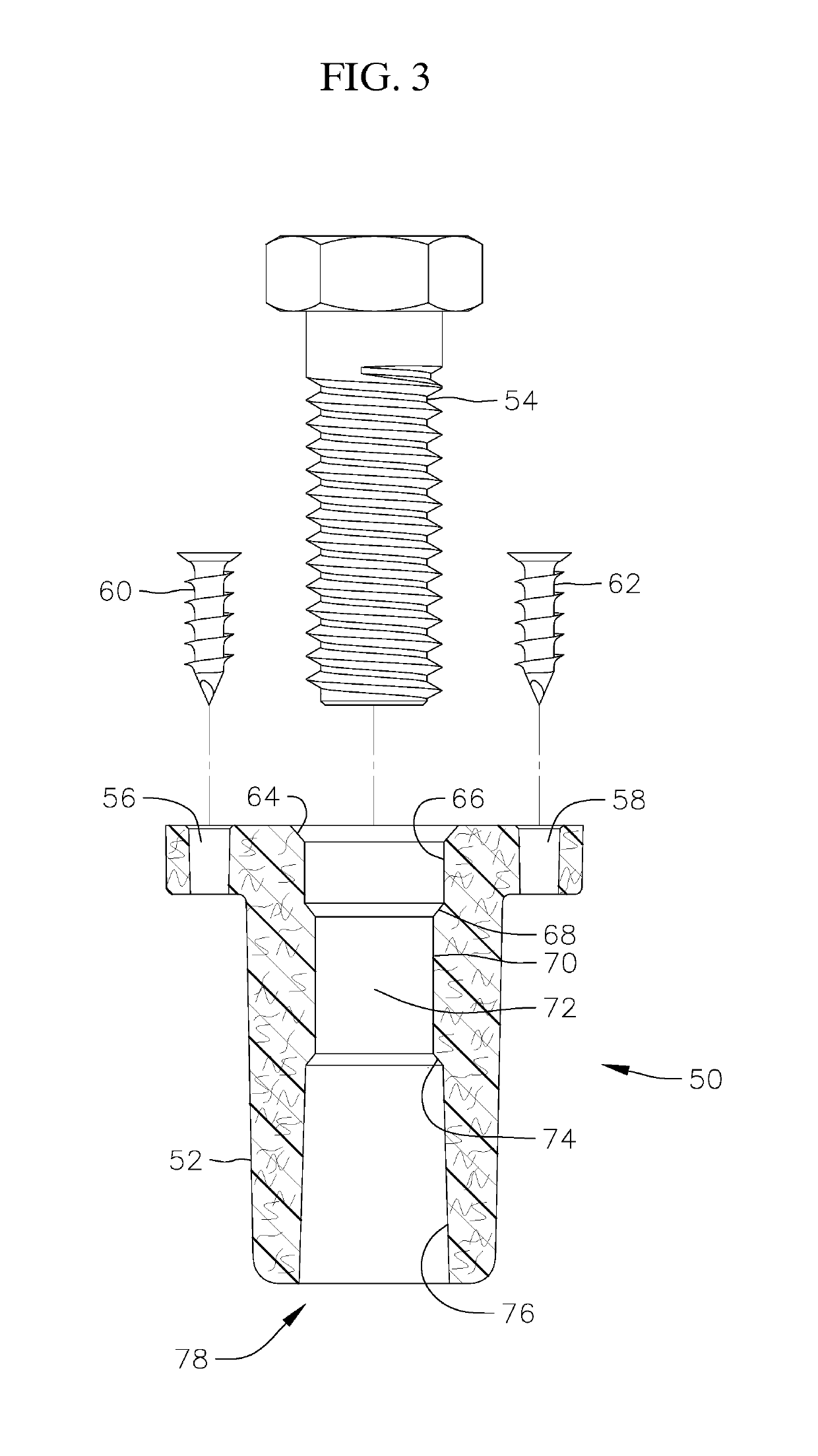 Fastening system allowing component removal after fastener system failure