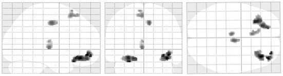 Application of kibra rs17070145 detection reagent in the preparation of olfactory function evaluation kit