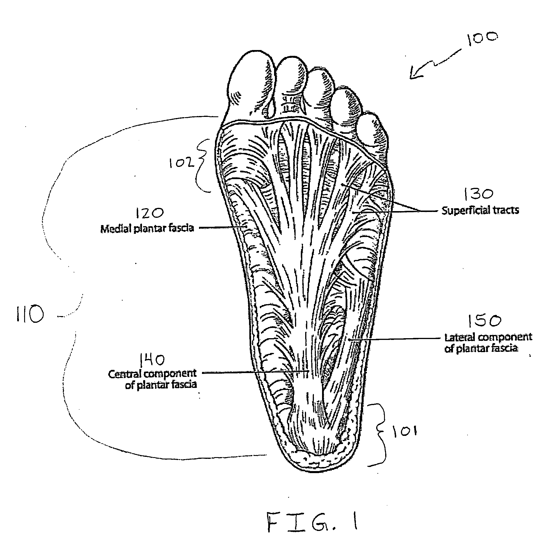 System for treatment of plantar fasciitis
