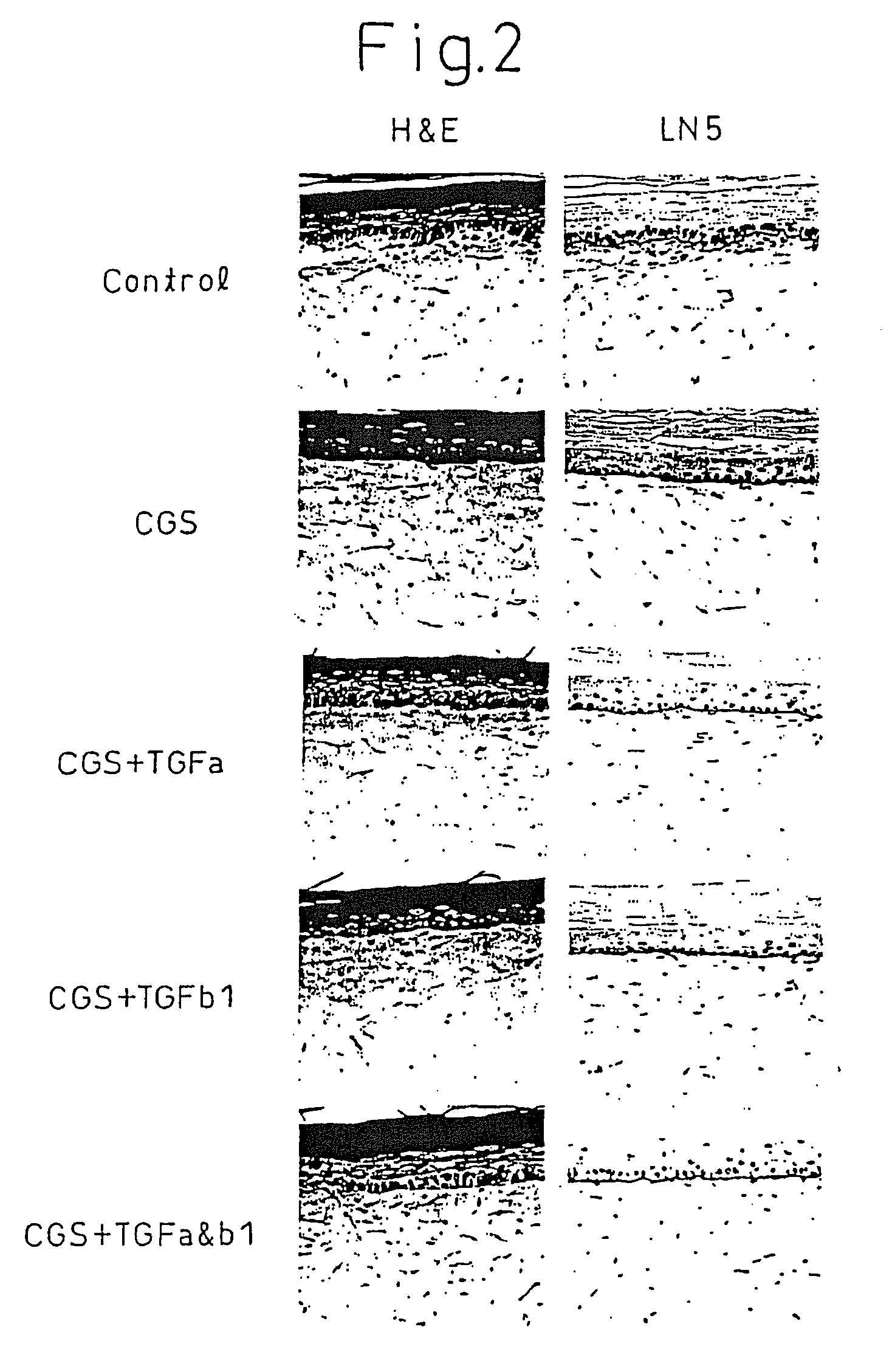 Method of production of artificial skin
