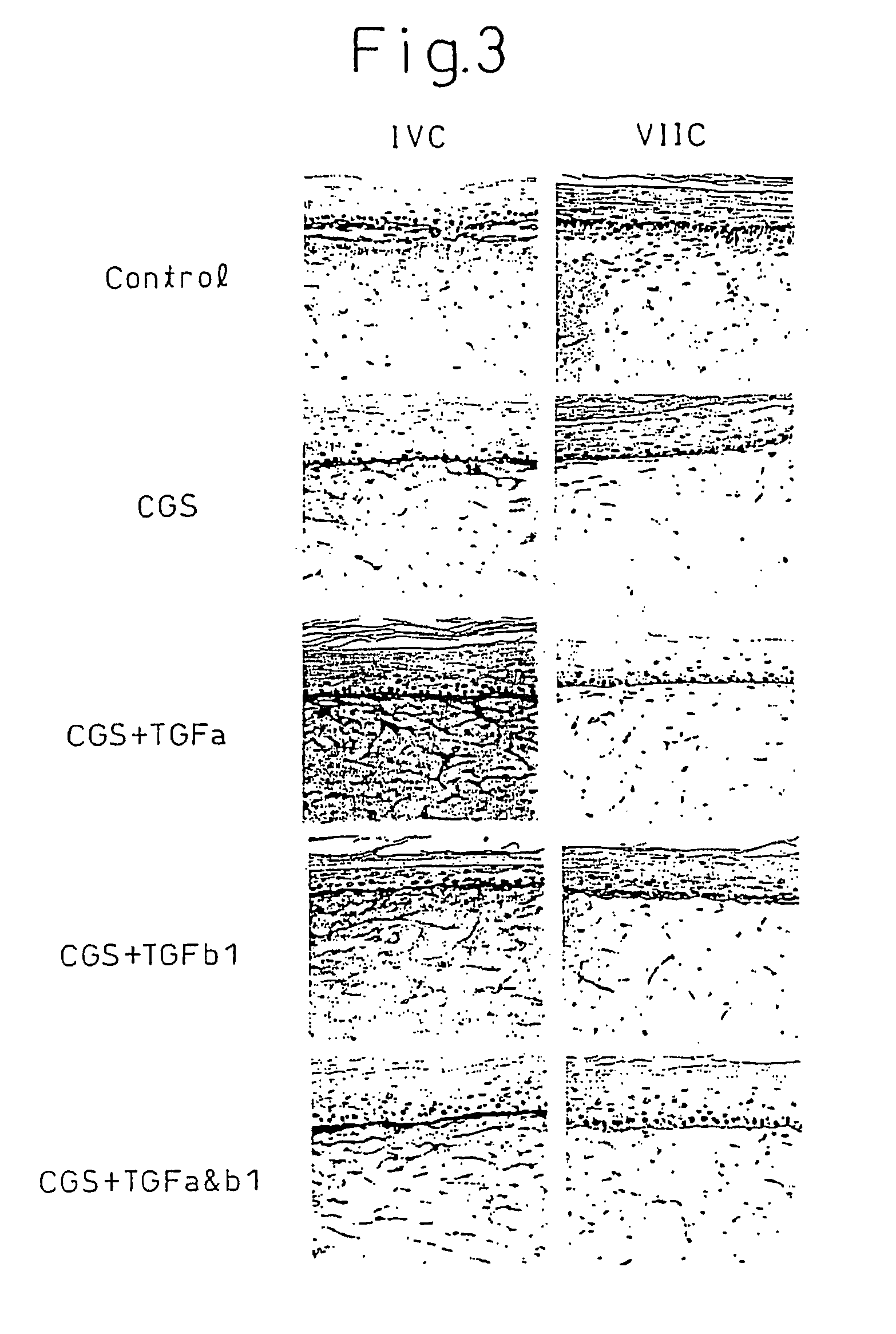 Method of production of artificial skin