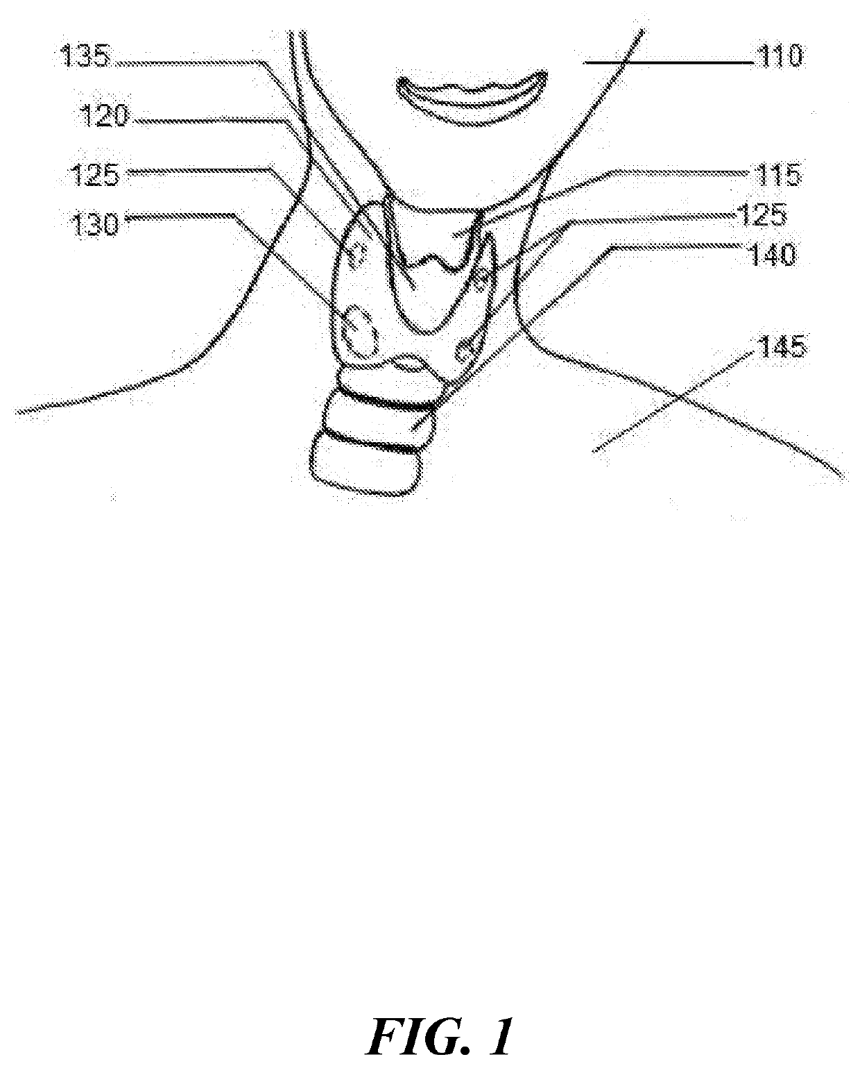 Tissue specific markers for preoperative and intraoperative localization and visualization of tissue