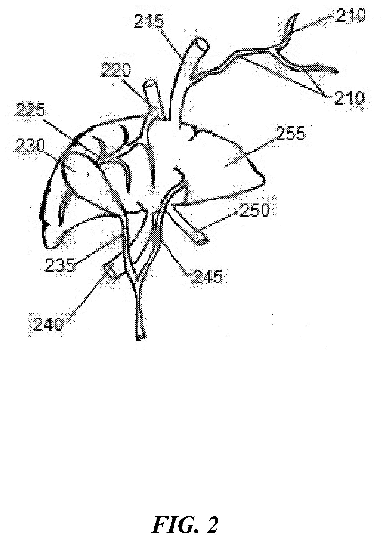Tissue specific markers for preoperative and intraoperative localization and visualization of tissue