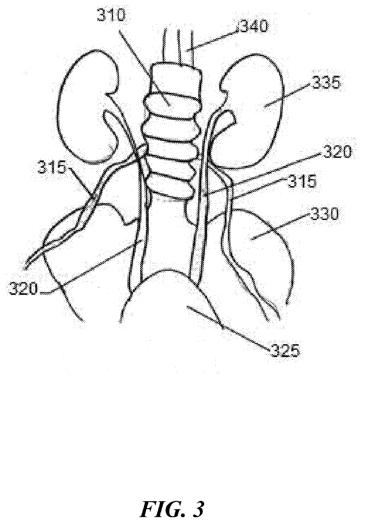 Tissue specific markers for preoperative and intraoperative localization and visualization of tissue