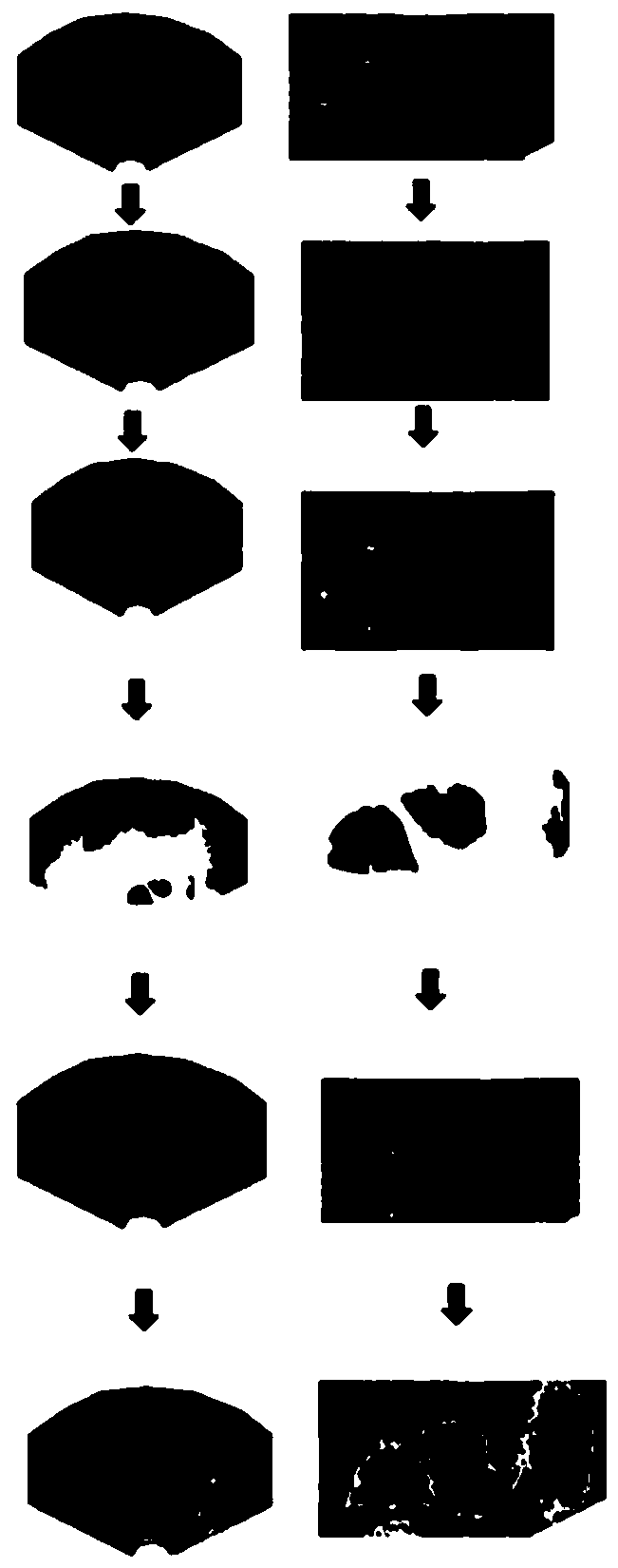 Follicle ultrasonic processing method and system based on level set image segmentation