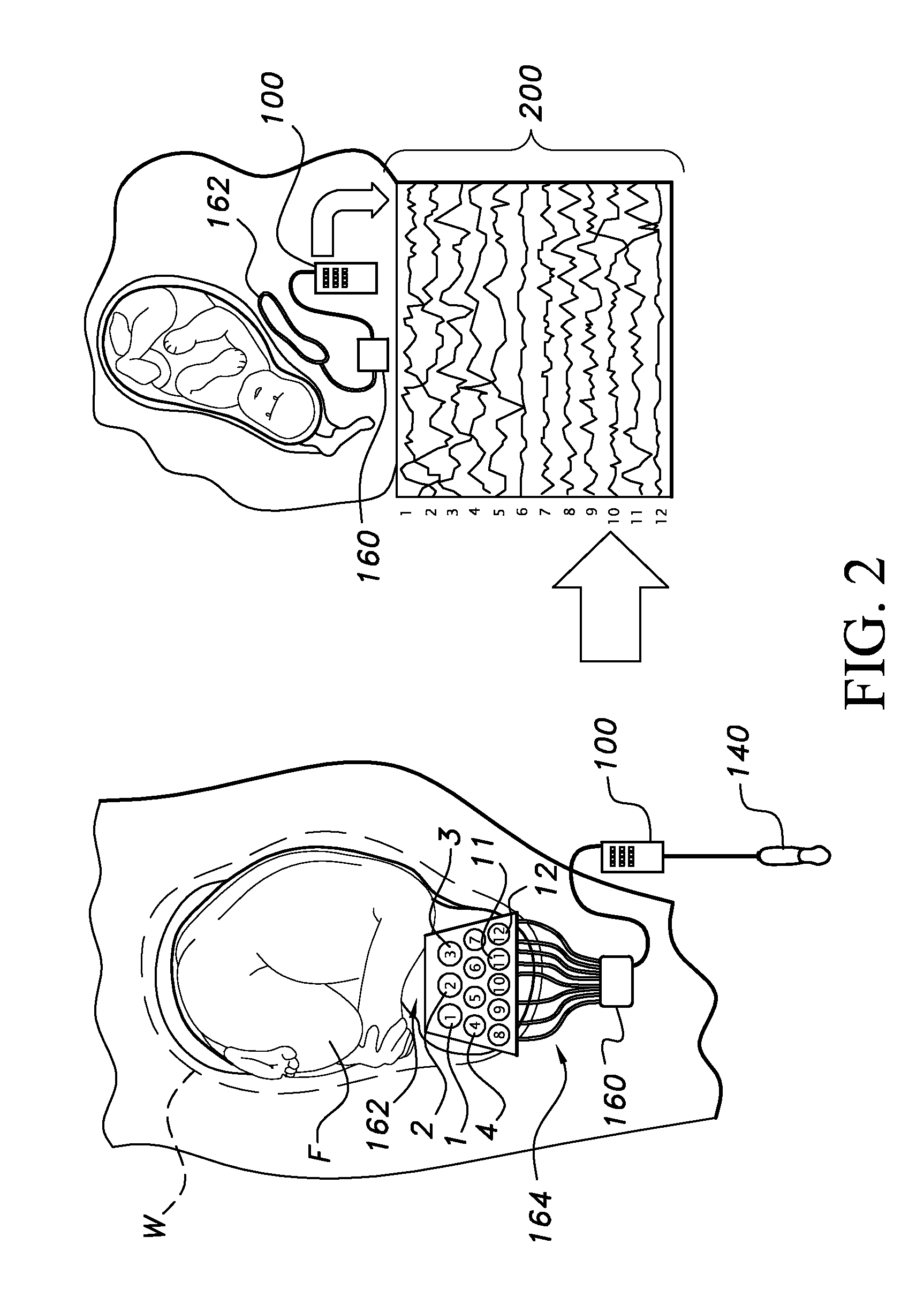 Portable fetal eeg-recording device and method of use