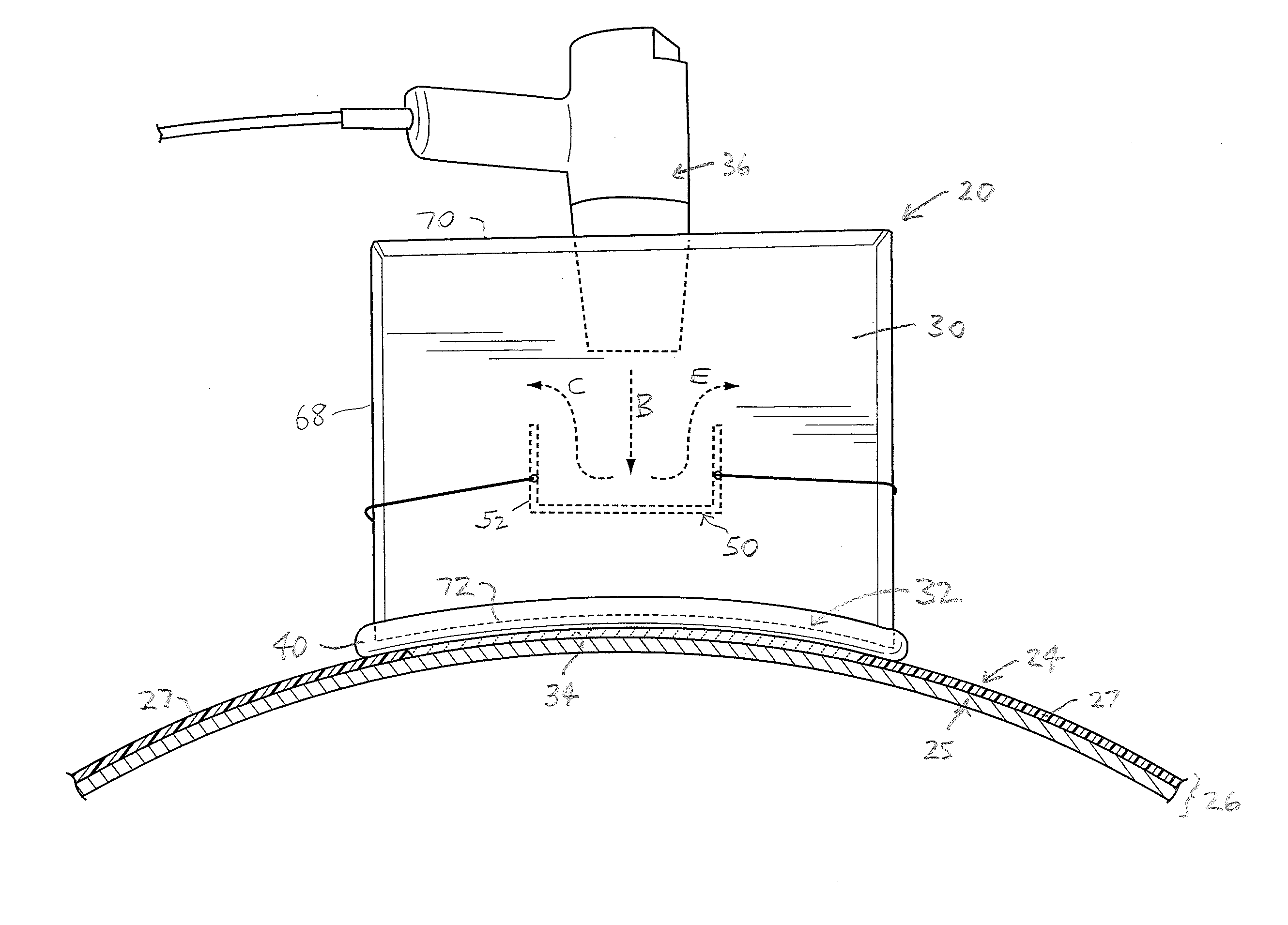 Pipe coating repair system