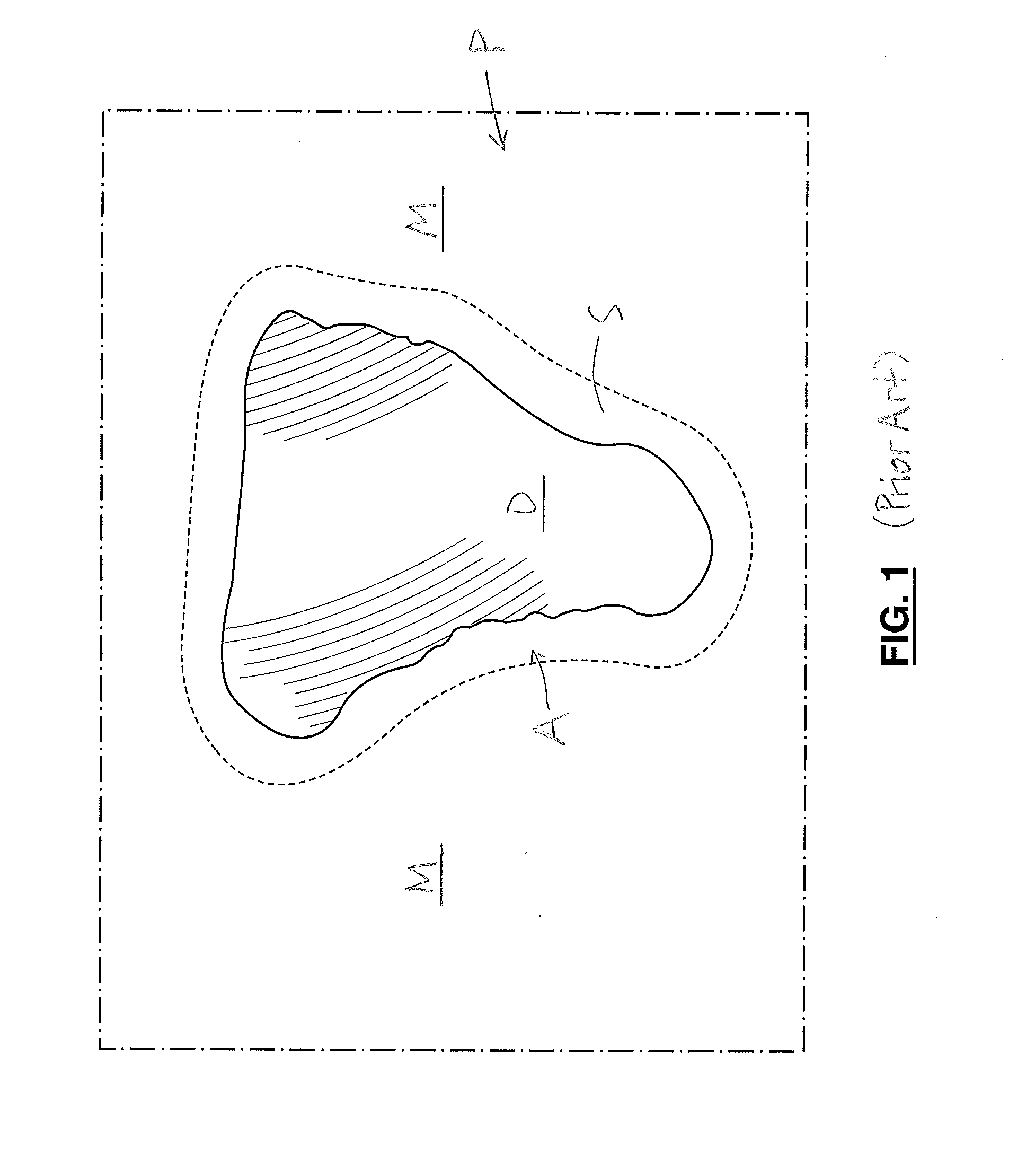 Pipe coating repair system