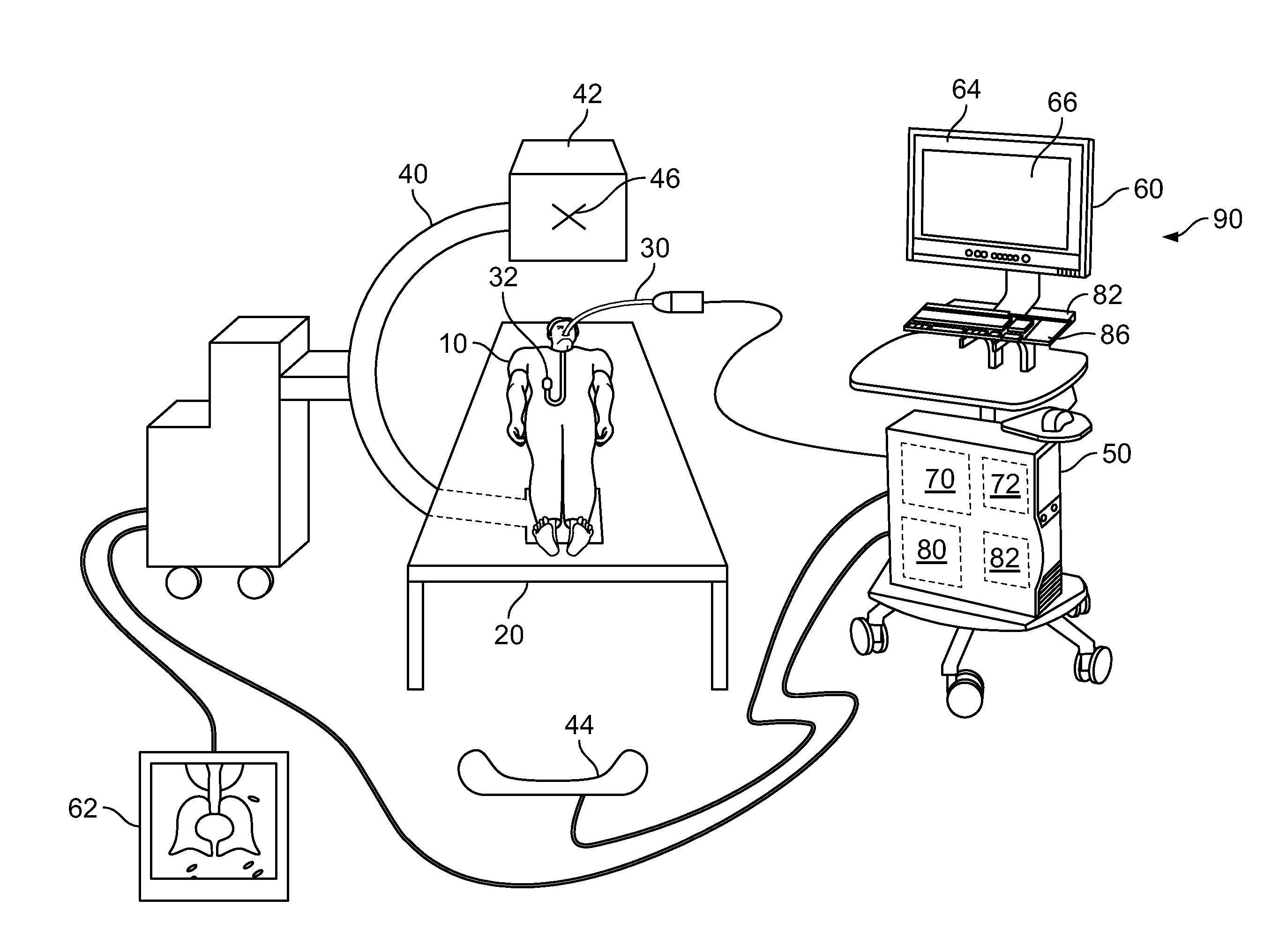 Gpu-based system for performing 2d-3d deformable registration of a body organ using multiple 2d fluoroscopic views