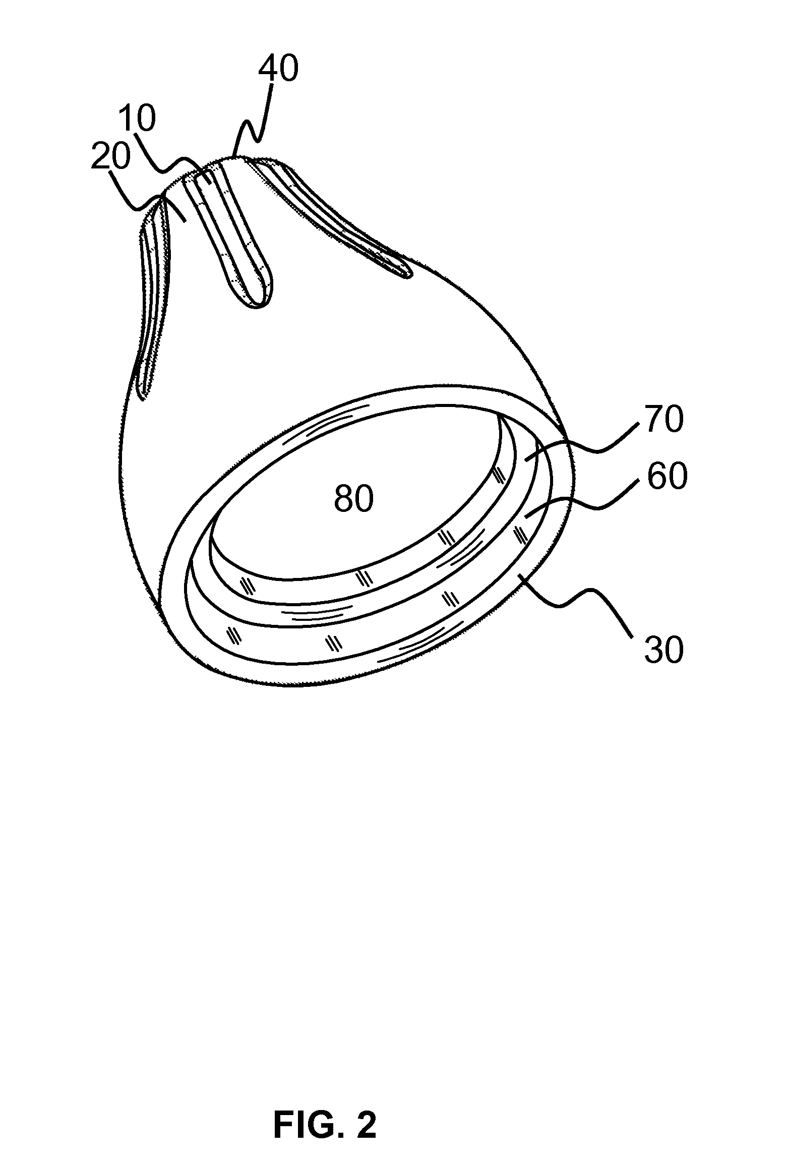 Partially Occluding Ergonomic Earbud Adapter