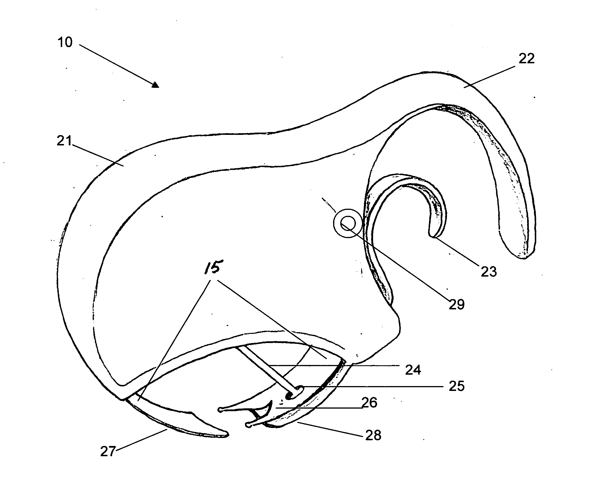 Band blade suture remover apparatus and method