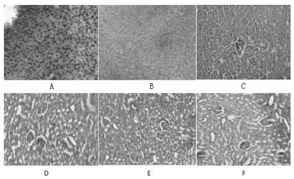 A veterinary Fengli granule and its application in chicken necrotizing enteritis