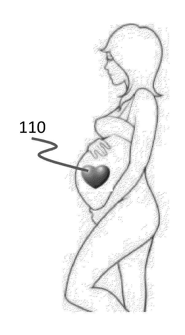 Fetal monitoring tattoo