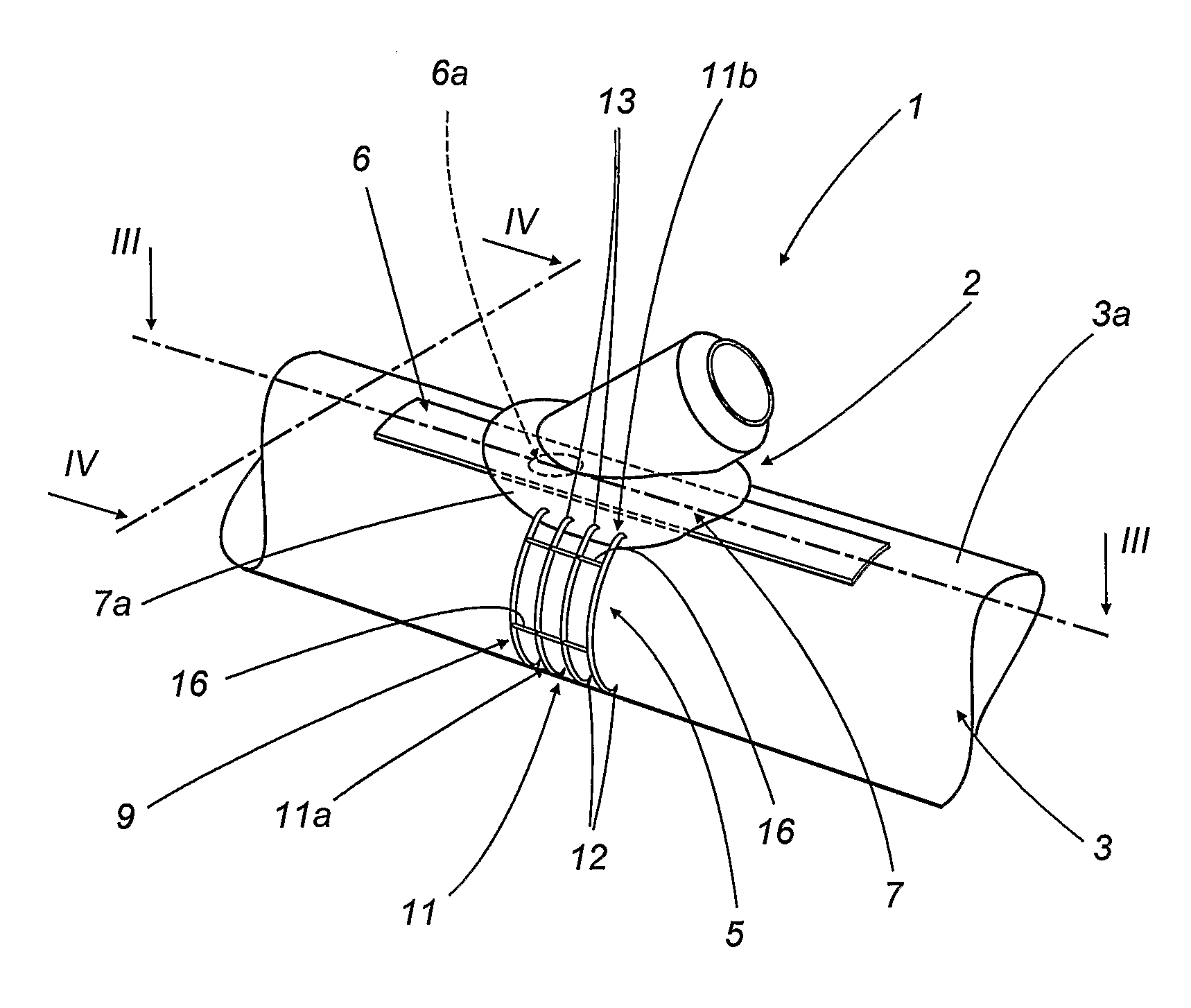 Device For End-To-Side Anastomosis
