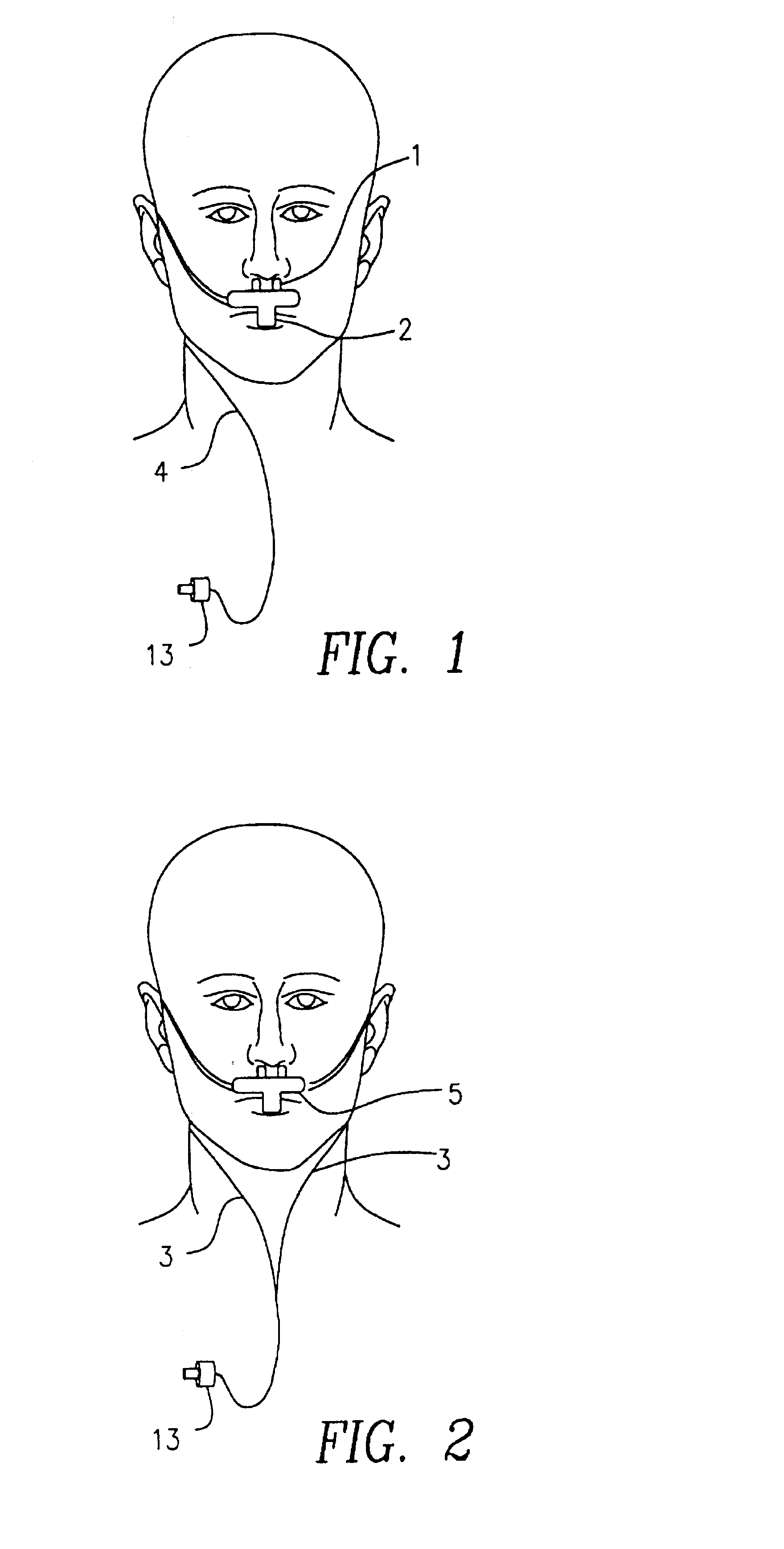 Device and method for monitoring respiration