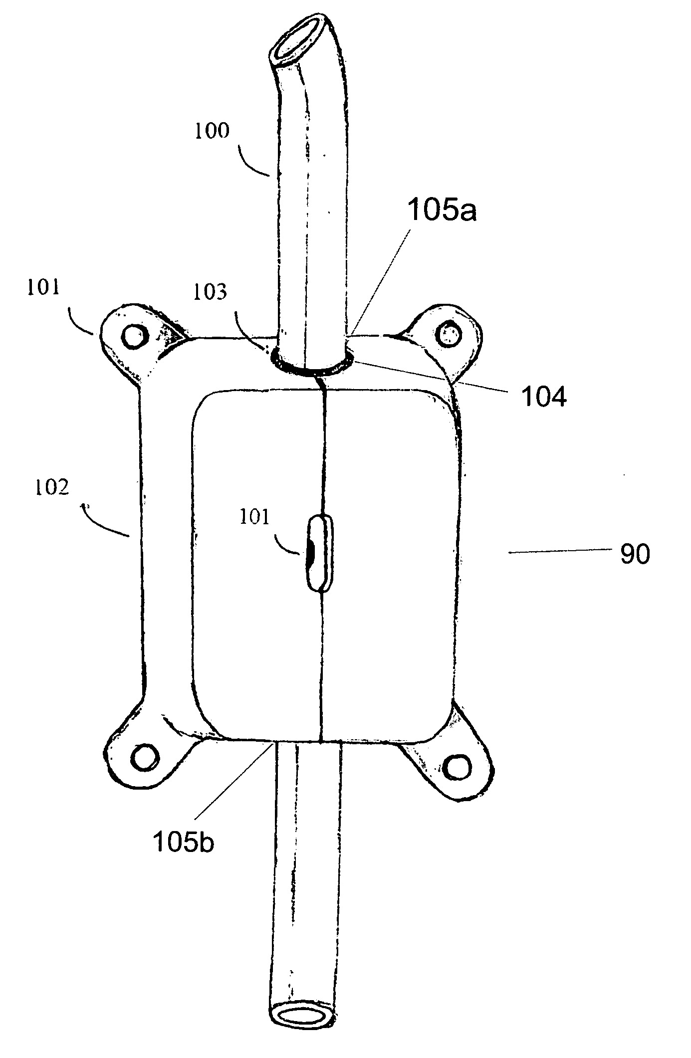 Implantable anti-clogging device for maintenance of cerebrospinal fluid shunt patency