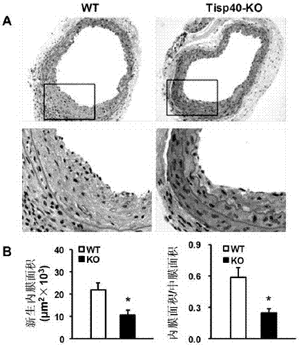 Function and application of transcription-induced spermatogenesis gene 40 (TISP40) in the treatment of restenosis after vascular injury