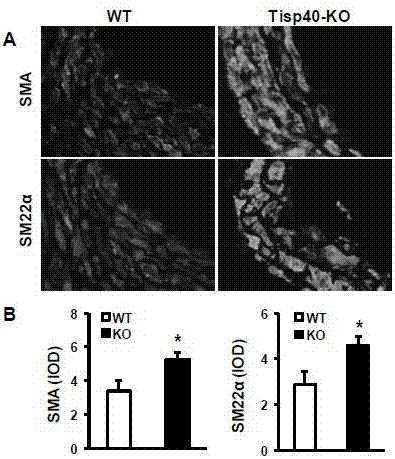 Function and application of transcription-induced spermatogenesis gene 40 (TISP40) in the treatment of restenosis after vascular injury