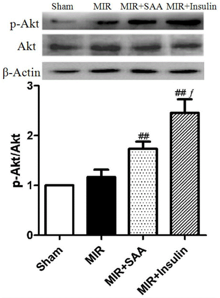 Application of amygdalin in protecting ischemic heart