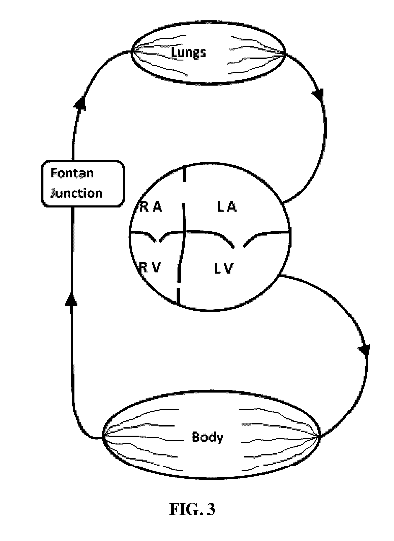 Implantable cardio-vascular flow streamliner