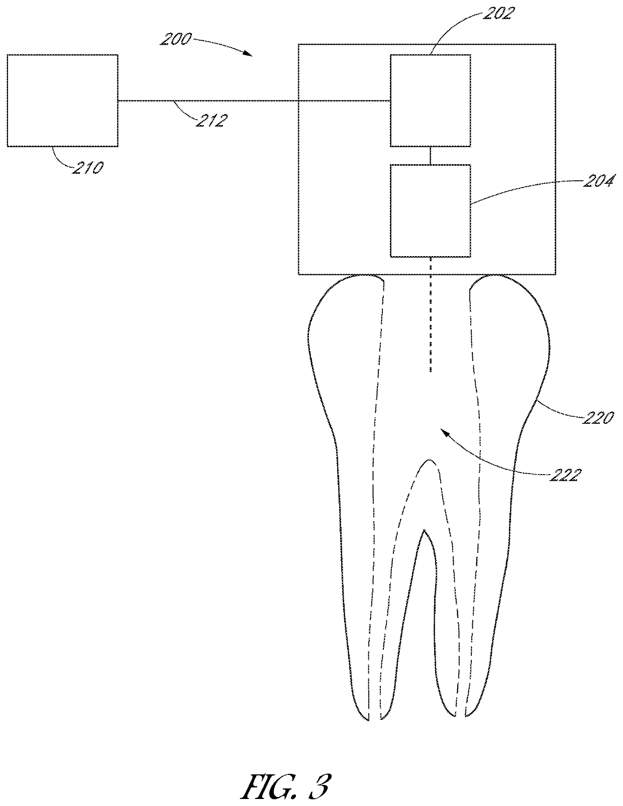 Apparatus and method for treating teeth