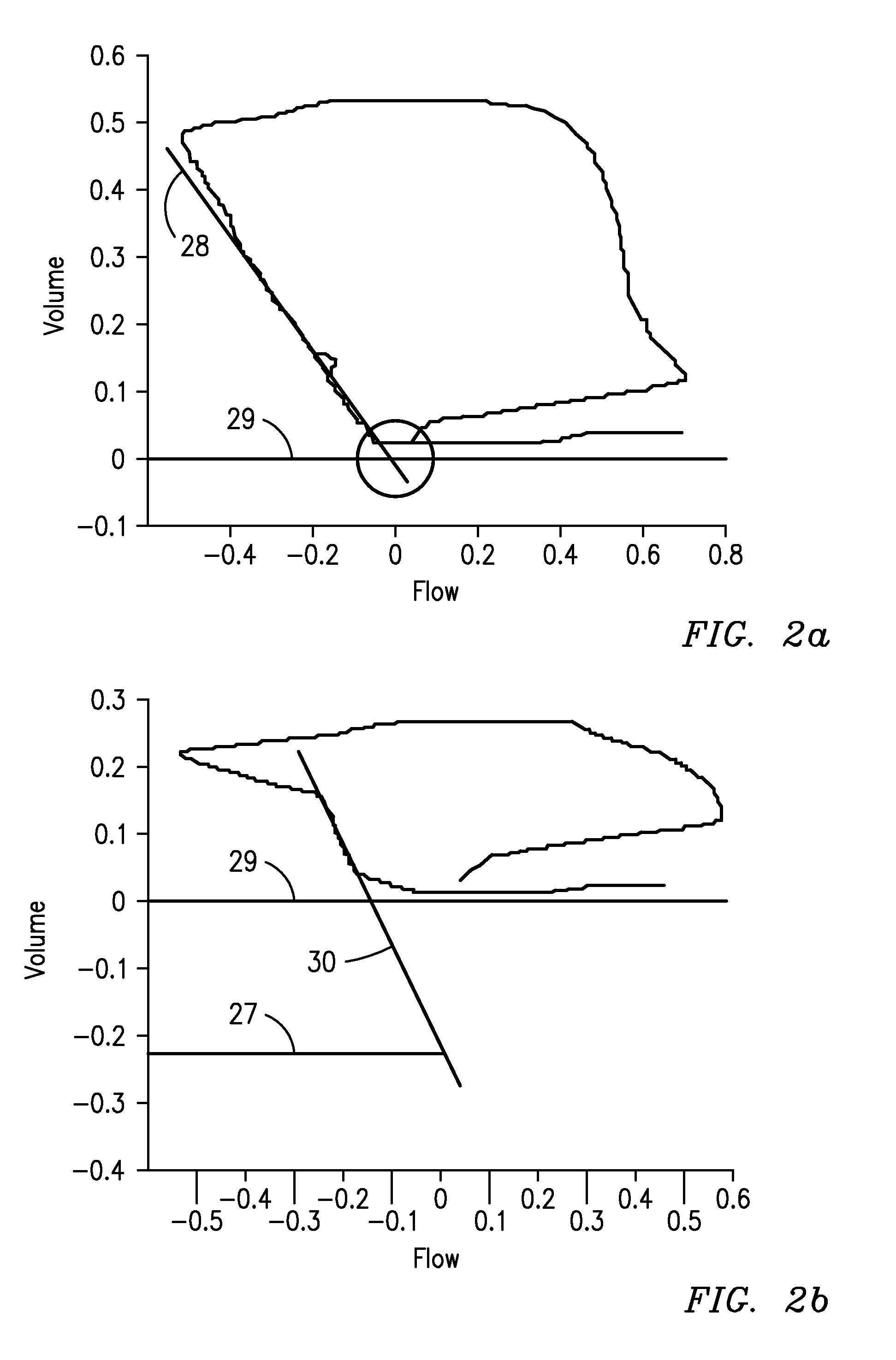 Method and apparatus for detecting and quantifying intrinsic positive end-expiratory pressure
