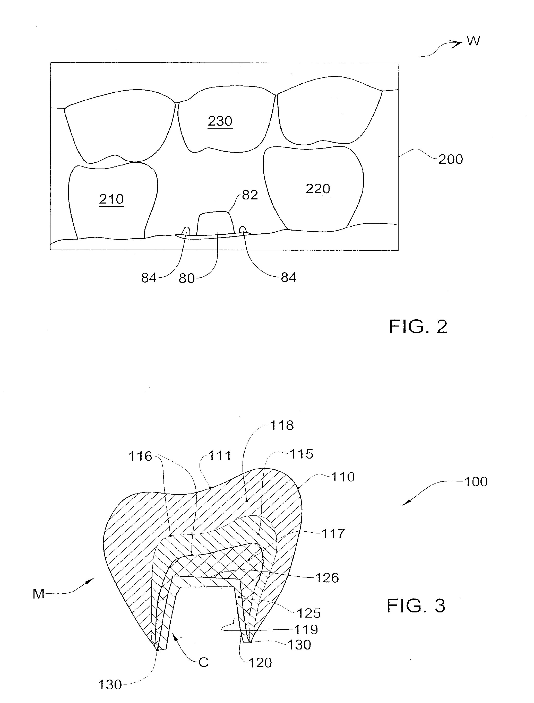 Method and system for designing and producing dental prostheses and appliances