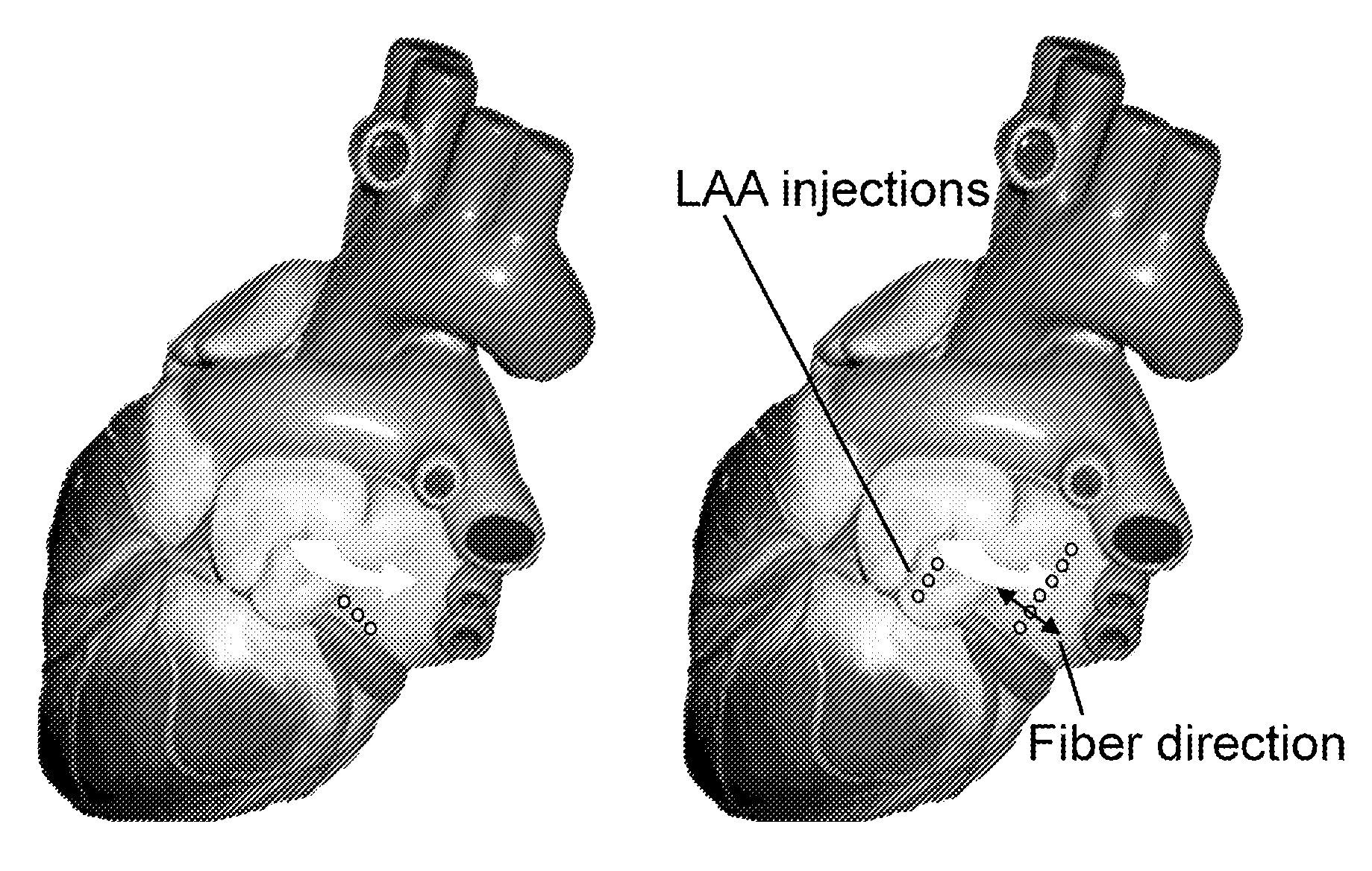 Delivery methods for a biological pacemaker minimizing source-sink mismatch