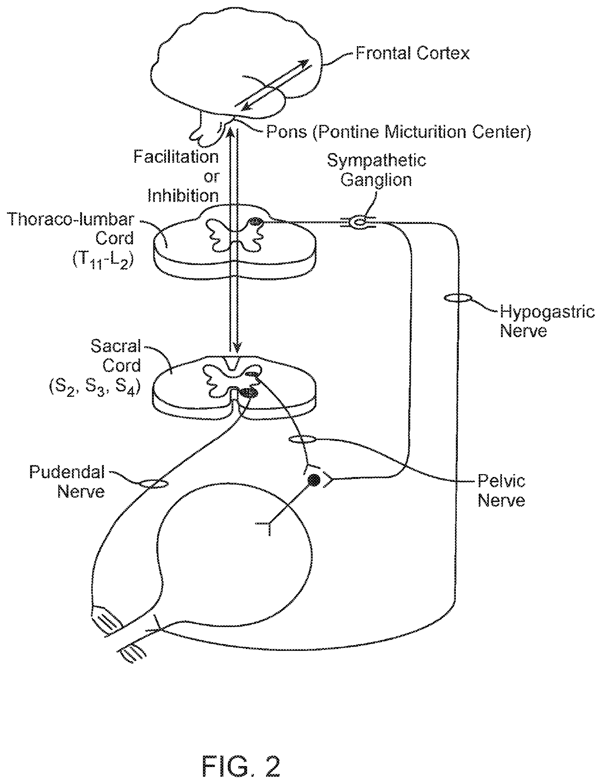 Systems and methods for patient-enabled bladder control